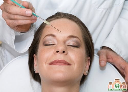 Hỏi Đáp Y Khoa Kỳ 21: Botox và Da Nhăn